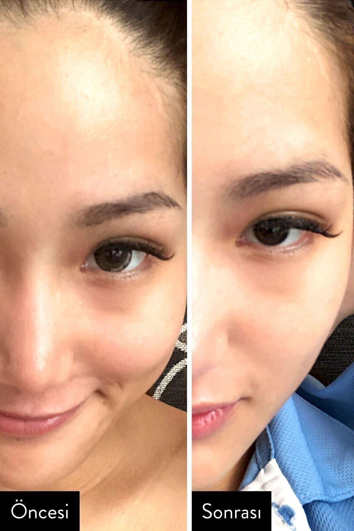 I'm From Rice Toner Arındırıcı Aydınlatıcı Pirinçli Tonik 150ml